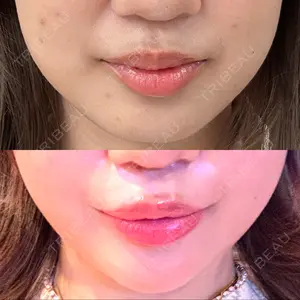 東京美容外科 東京美容外科 福岡院口コミ