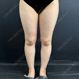 藤・ナチュレ美容クリニック 藤・ナチュレ美容クリニック 銀座院口コミ