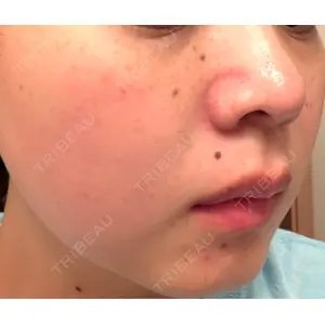 ルラ美容クリニック ルラ美容クリニック 仙台院 / ルラスキンクリニック 仙台院口コミ