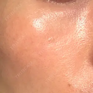 品川スキンクリニック広島院の