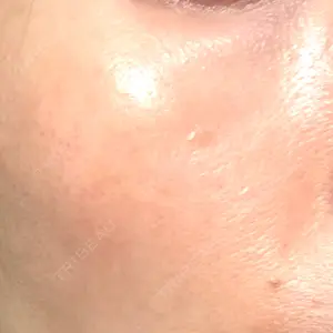 品川スキンクリニック広島院の