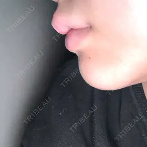 ルラ美容クリニック ルラ美容クリニック 札幌大通り院口コミ