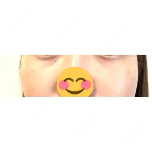 プラストクリニック口コミ