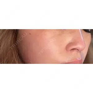 ルラ美容クリニック ルラ美容クリニック 仙台院 / ルラスキンクリニック 仙台院口コミ