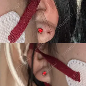 新宿ラクル美容外科クリニック 新宿ラクル美容外科クリニック 六本木院口コミ