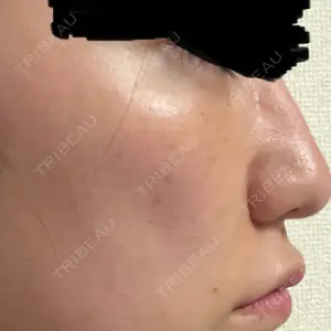 フィラークリニック フィラークリニック 渋谷院口コミ