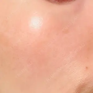 品川スキンクリニック広島院の