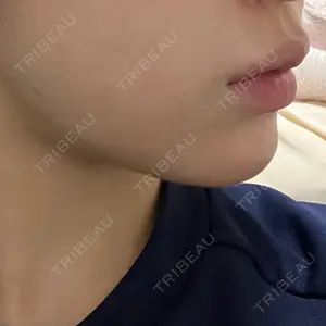 ルラ美容クリニック ルラ美容クリニック 大阪本院口コミ