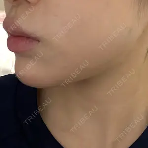 ルラ美容クリニック ルラ美容クリニック 大阪本院口コミ