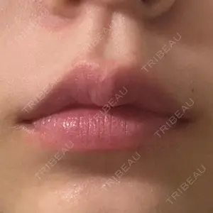 ビラビューティークリニック 博多美容外科/美容皮膚科 ビラビューティークリニック口コミ