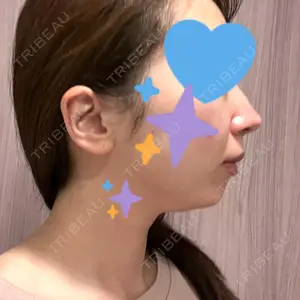 HINATA クリニック口コミ