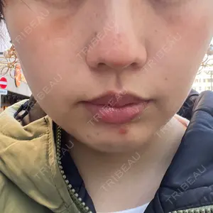 口コミ