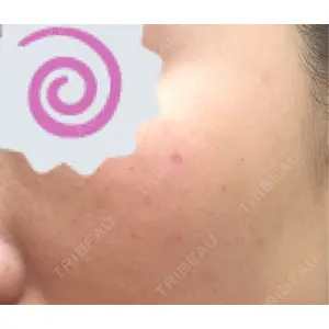 ルラ美容クリニック ルラ美容クリニック 札幌大通り院口コミ