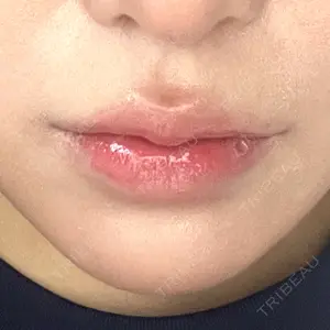 ルラ美容クリニック ルラ美容クリニック 大阪本院口コミ