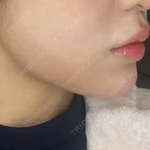 ルラ美容クリニック ルラ美容クリニック 大阪本院口コミ