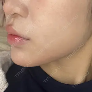 ルラ美容クリニック ルラ美容クリニック 大阪本院口コミ