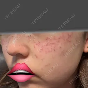 東京シルククリニック 東京シルククリニック 新宿院口コミ