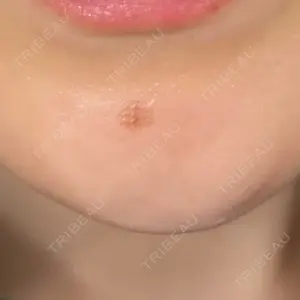 Designo Clinic （デジーノクリニック）口コミ