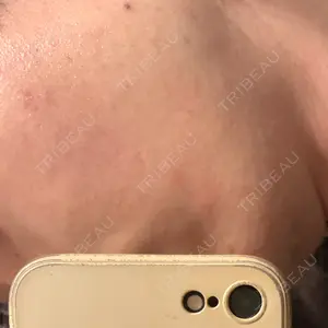 やさしい美容皮膚科・皮フ科 やさしい美容皮膚科・皮フ科　秋葉原院口コミ