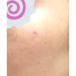 ルラ美容クリニック ルラ美容クリニック 札幌大通り院口コミ