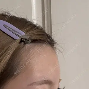 ビラビューティークリニック 博多美容外科/美容皮膚科 ビラビューティークリニック口コミ