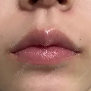 ビラビューティークリニック 博多美容外科/美容皮膚科 ビラビューティークリニック口コミ