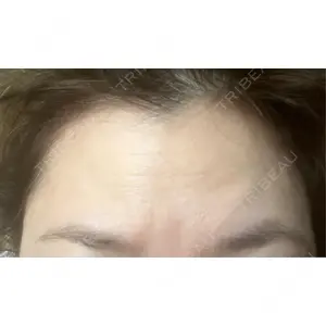 TCB東京中央美容外科 TCB東京中央美容外科 北千住院口コミ