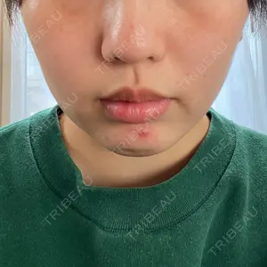 口コミ
