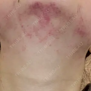 ゆきスキンクリニック 東池袋口コミ