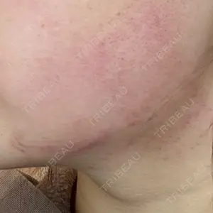 ゆきスキンクリニック 東池袋口コミ