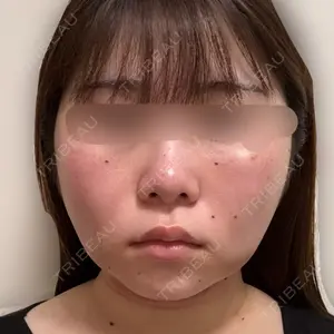 湘南美容クリニック 湘南美容クリニック 松戸院口コミ