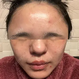 アクティブエイジクリニック アクティブエイジクリニック口コミ