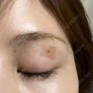 あいちビューティークリニック あいちビューティークリニック栄本院口コミ