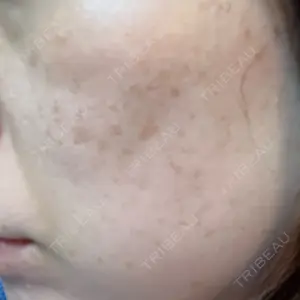 Designo Clinic （デジーノクリニック）口コミ