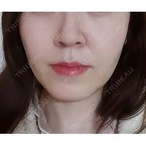 L‘amour clinic Tokyo【ラムールクリニック東京】口コミ