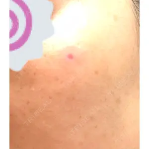 ルラ美容クリニック ルラ美容クリニック 札幌大通り院口コミ