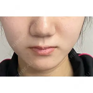 Natural Skin Clinic Natural Skin Clinic 笹塚院口コミ