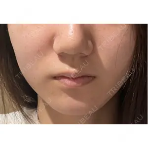 Natural Skin Clinic Natural Skin Clinic 笹塚院口コミ