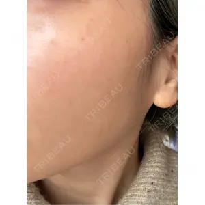 PureMe Skin Clinic（ピュアミースキンクリニック麻布）口コミ