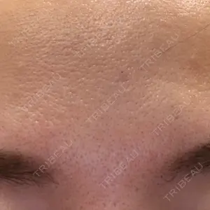 TCB東京中央美容外科 TCB東京中央美容外科 千葉駅前院口コミ