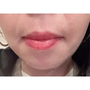 BiBiクリニック口コミ