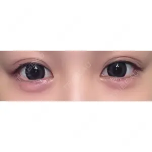 ルラ美容クリニック ルラ美容クリニック 大宮院 / ルラスキンクリニック 大宮院口コミ