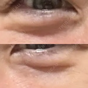 セオリークリニック口コミ