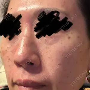 東京シルククリニック 東京シルククリニック 新宿院口コミ