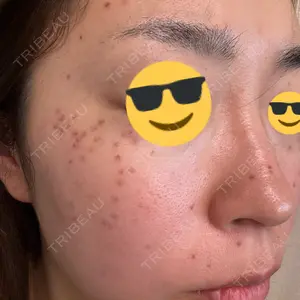 東京シルククリニック 東京シルククリニック 新宿院口コミ