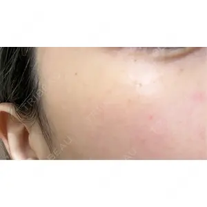 PureMe Skin Clinic（ピュアミースキンクリニック麻布）口コミ