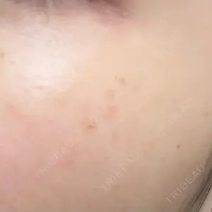 PureMe Skin Clinic（ピュアミースキンクリニック麻布）口コミ