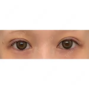 アリエル美容クリニック アリエル美容クリニック 郡山院口コミ