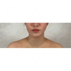 アリエル美容クリニック アリエル美容クリニック 横浜院口コミ