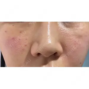 ギャラリークリニック ギャラリークリニック 銀座口コミ